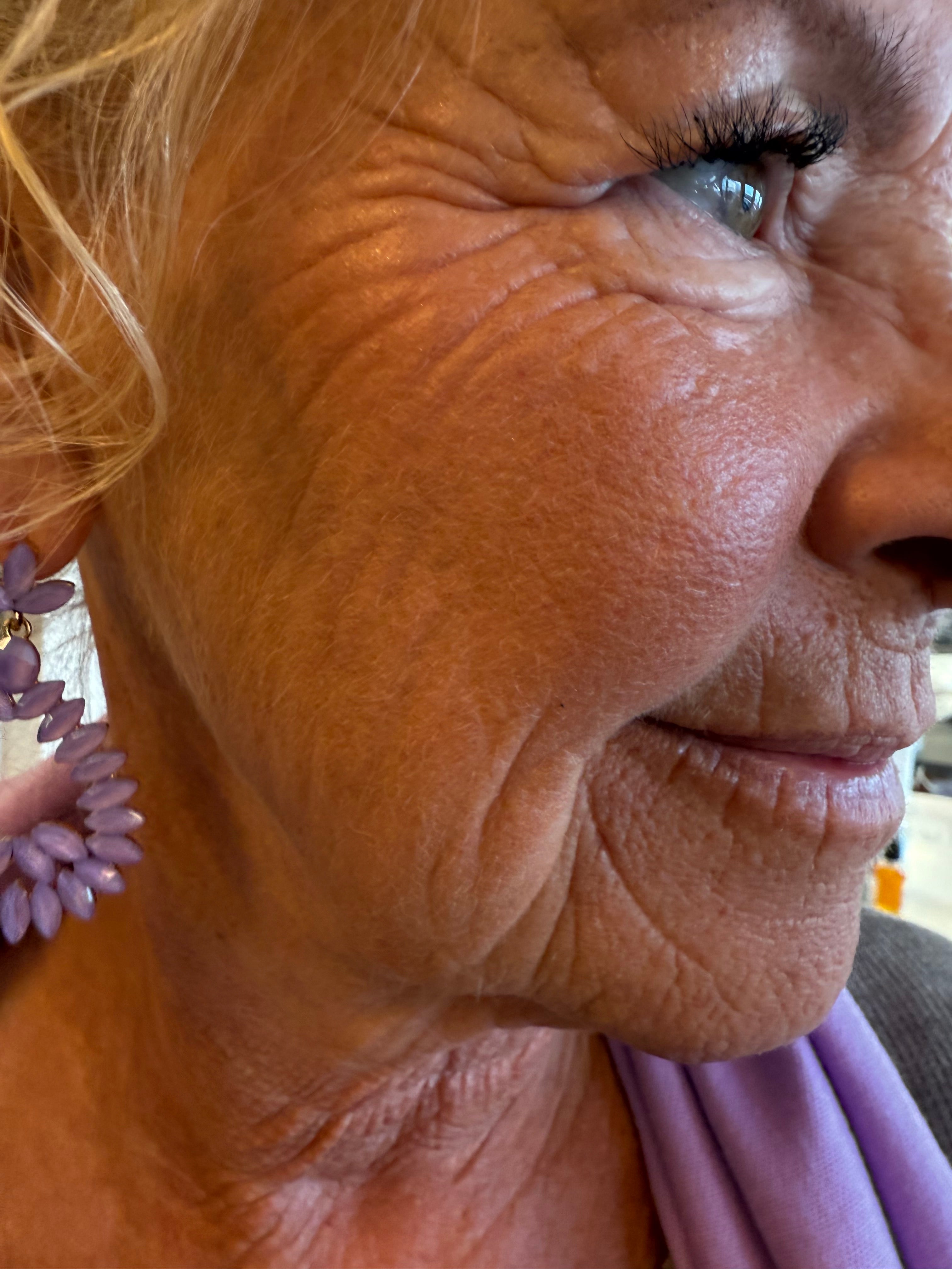 Eye Renewal Cream Peptide-8, 20 ml