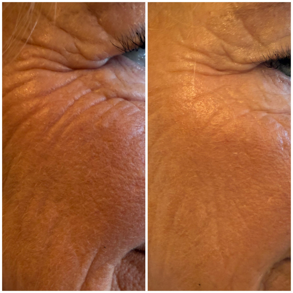 Eye Renewal Cream Peptide-8, 20 ml