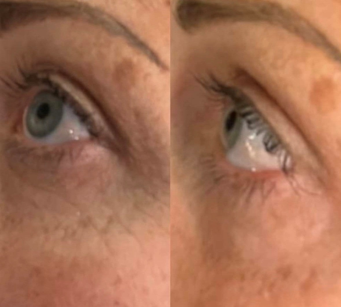 Eye Renewal Cream Peptide-8, 20 ml