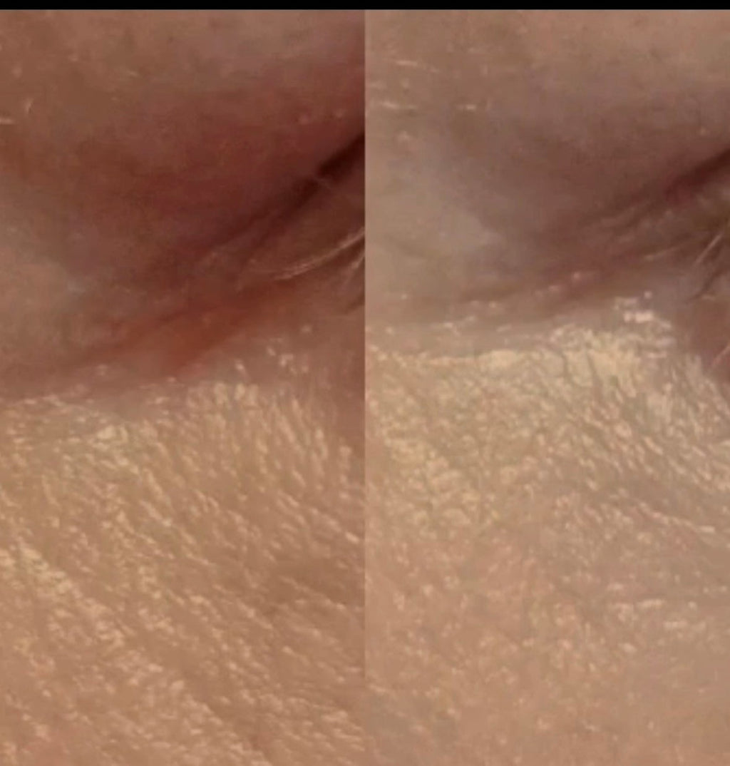 Eye Renewal Cream Peptide-8, 20 ml