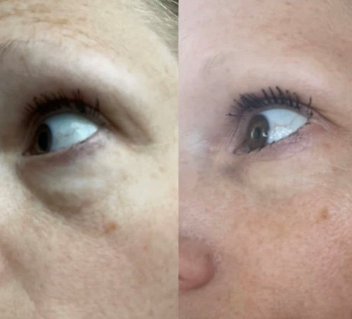 Eye Renewal Cream Peptide-8, 20 ml